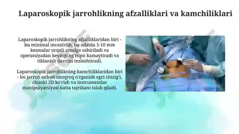 Laparoskopiyaning jarrohlikda qo’llanilishi 4