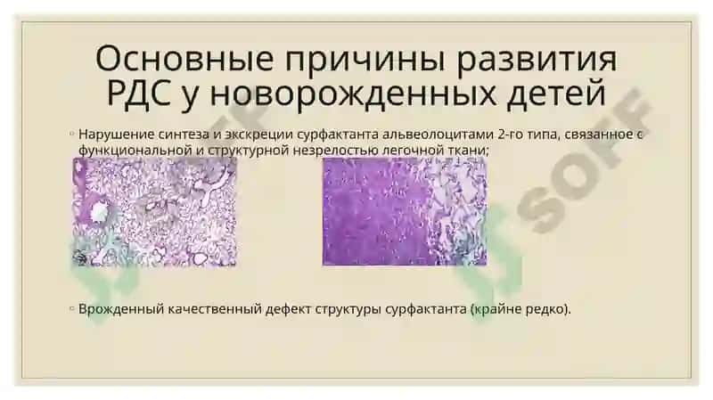 Клинические рекомендации «Ведение новорожденных с респираторным дистресс синдромом» 2016 4