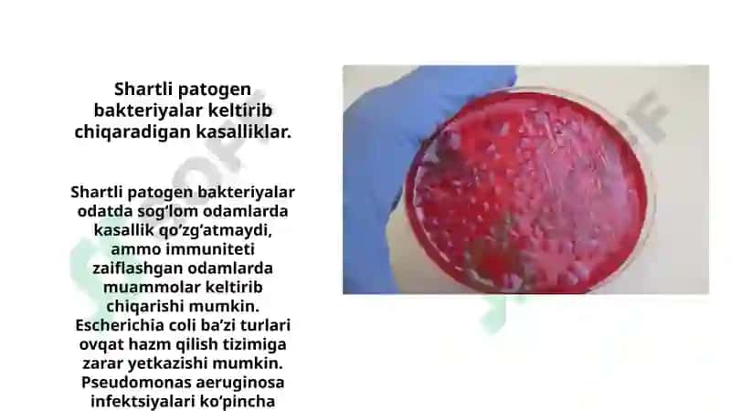 Shartli patogen dioriyaogen ichak gruppa bakteriyalari, Sitrobakter, Klebsiella, Enterobakter 4