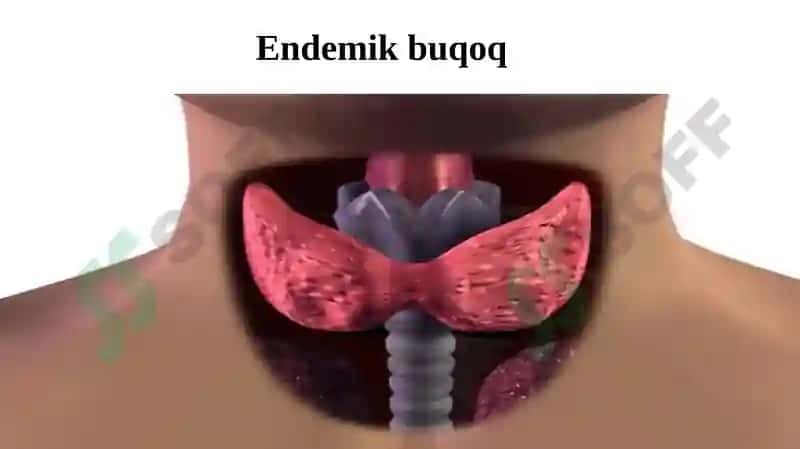 Endemik kasalliklarni oldini olishning gigiyenik asoslari 4