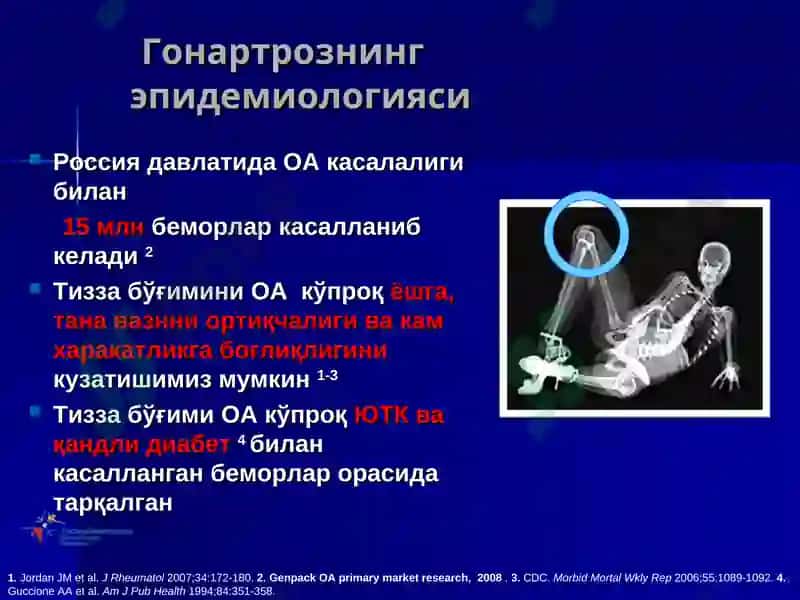 Буғим синдромини таққослама ташхиси ва умумий амалиёт шифокори тактикаси 4