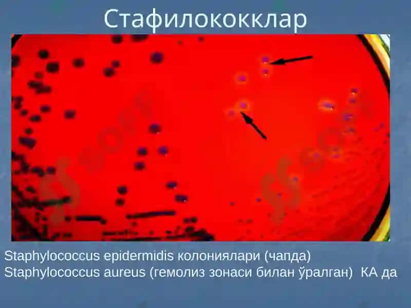 Йирингли яллиғланиш жараёнларини келтириб чиқарувчи микроорганизимлар. 4