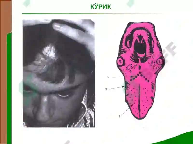 Жигар ва ўт йуллари касалликлари билан касалланган беморларни текшириш 4