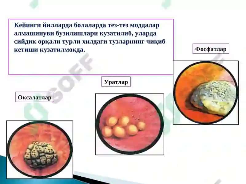 Моддалар алмашинуви ва касалликлари 4