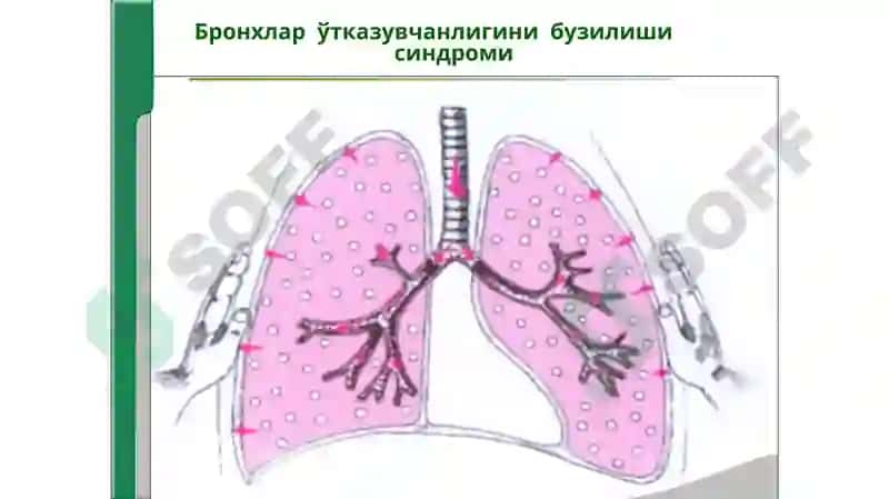 НАФАС ОРГАНЛАРИ КАСАЛЛИКЛАРИДА АСОСИЙКЛИНИК СИНДРОМЛАР 4