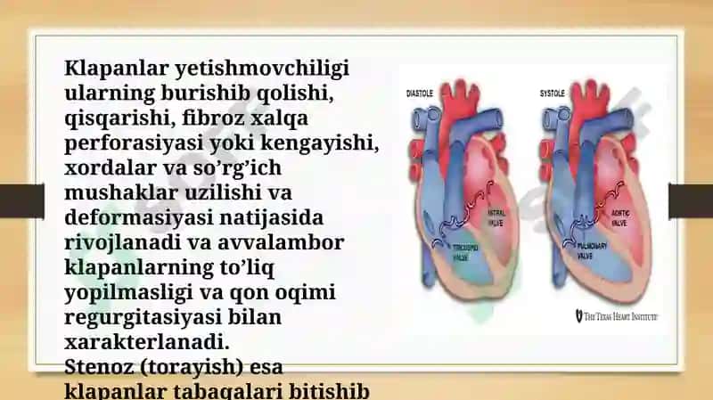 Mitral klapan nuqsonlari 4