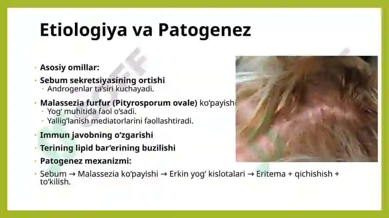 Seboreya. Pushti rangli xusnbuzarlar. Chaqaloqlarning yiringli  kasalliklari. Layell va Stivens-Djonson sindromlari 4