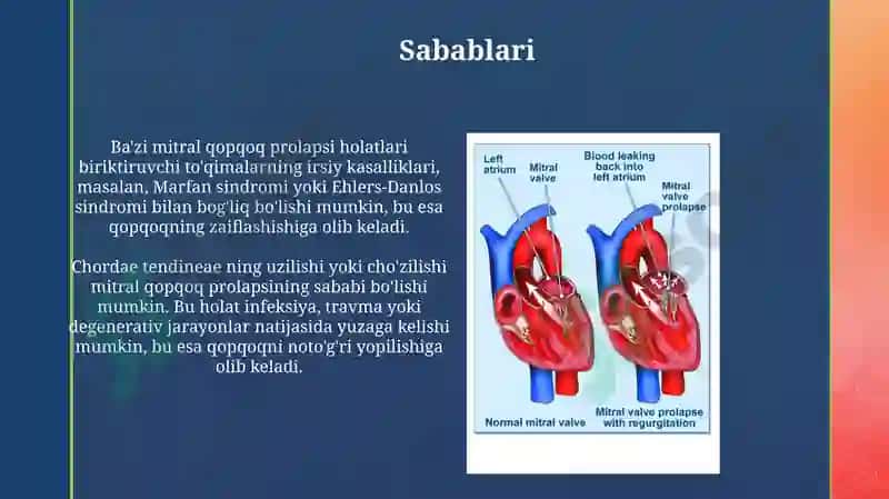 Mitral qopqoq prolapsi 4