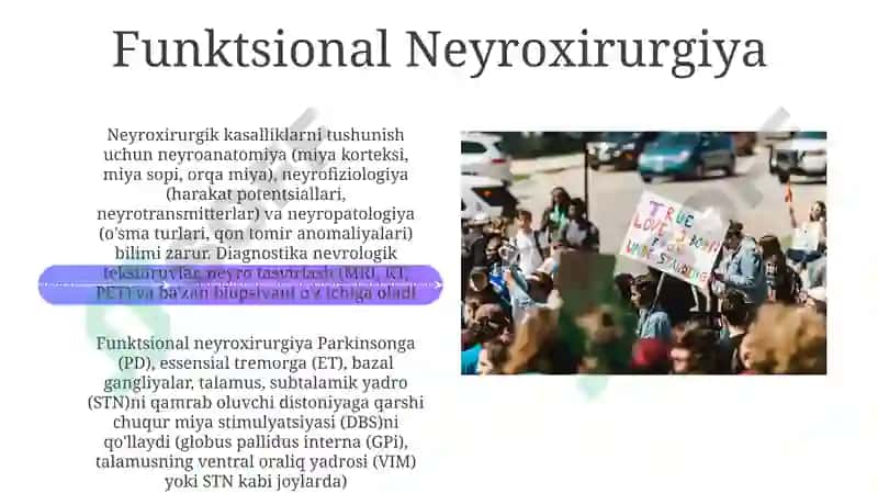 Neyroxirurgik kasalliklari haqida tushuncha 4