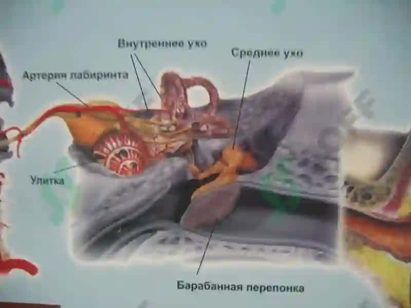 Острые и хронические заболевания среднего уха 4