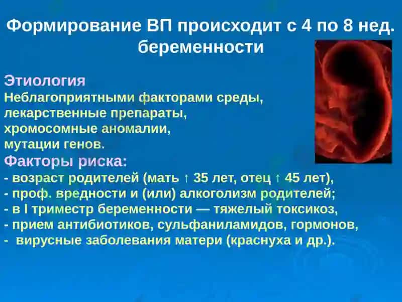 Врожденные пороки сердца 4