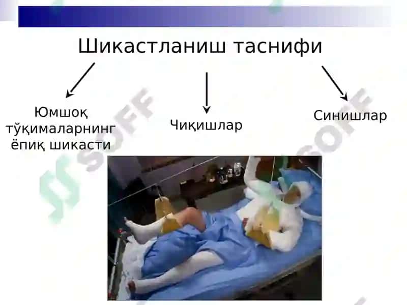 Шикастланишлар 4