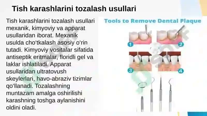 Tish karashlari. Tish karashlarini tozalash usullari, asbob-uskunalar. Parodont to’qimasini patologiyasi bor bemorlarni tekshirish usullari (asosiy va qo’shimcha usullar). Parodont to’qimasini tuzilishi, funksiyasi. Parodont kasalliklarini tasnifi 4
