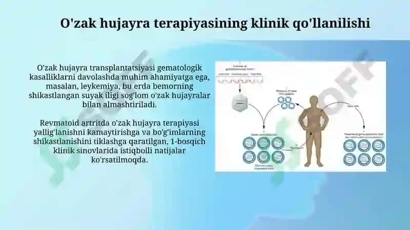 O'zak hujayra terapiyasi 4