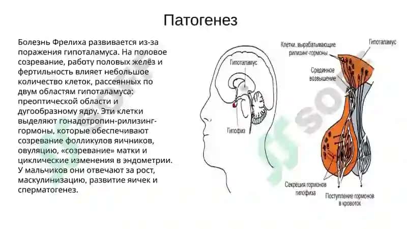 адипозогенитальная дистрофия 4