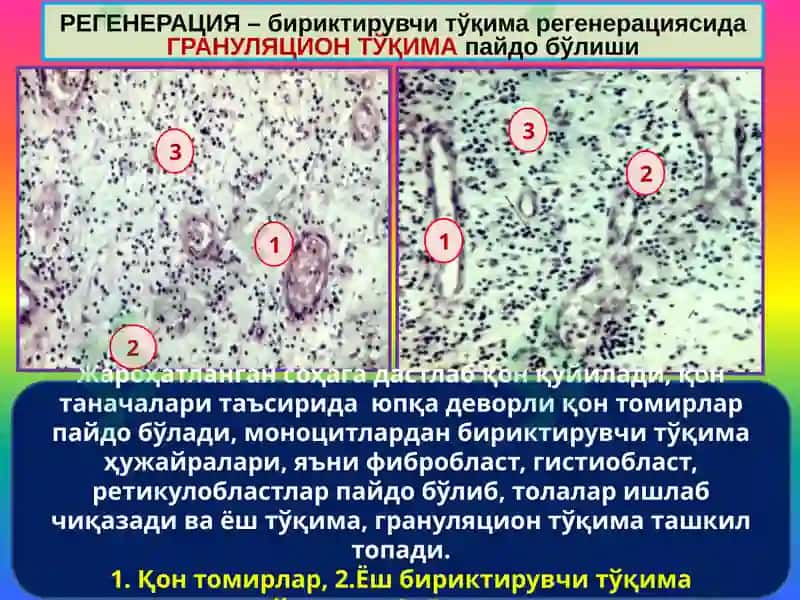 Мосланиш-ўрин алмашиниш жараёнлари. Гипертрофия, атрофия, гиперплазия, метаплазия, дисплазия 4