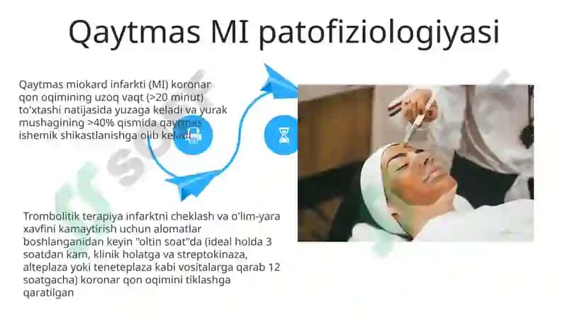 Trombolitik vositalar va mexanizmlar 4