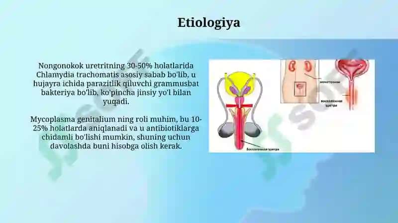 Nogonokokli uretritlar 4