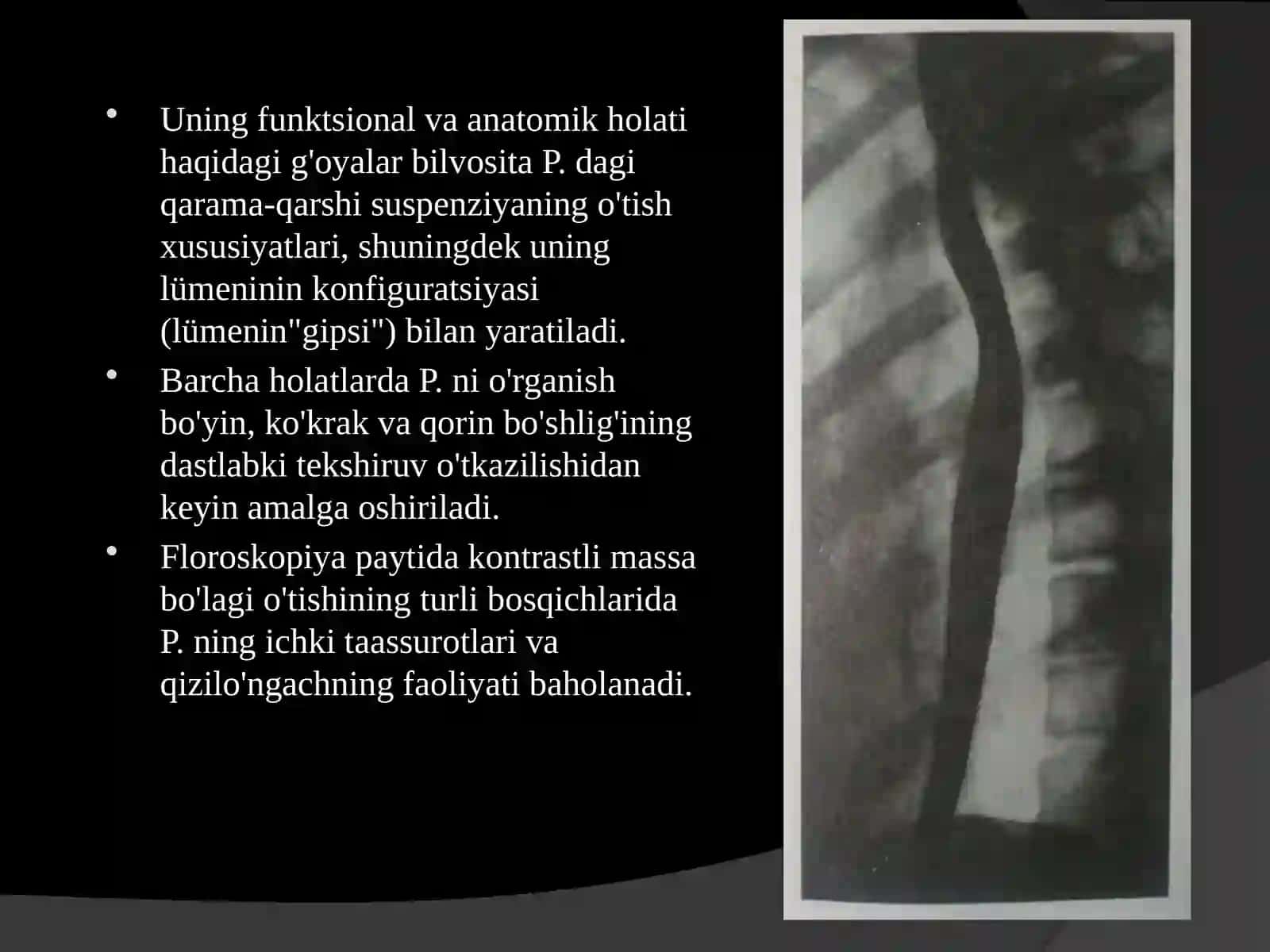 Oshqozon-ichak traktining rentgenologik anatomiyasi va rentgenopatologiyasi 4