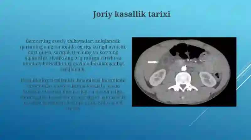 Òtkir virusli gepatitlar bilan kasallangan bemorlarga kasallik tarixi yozish 4