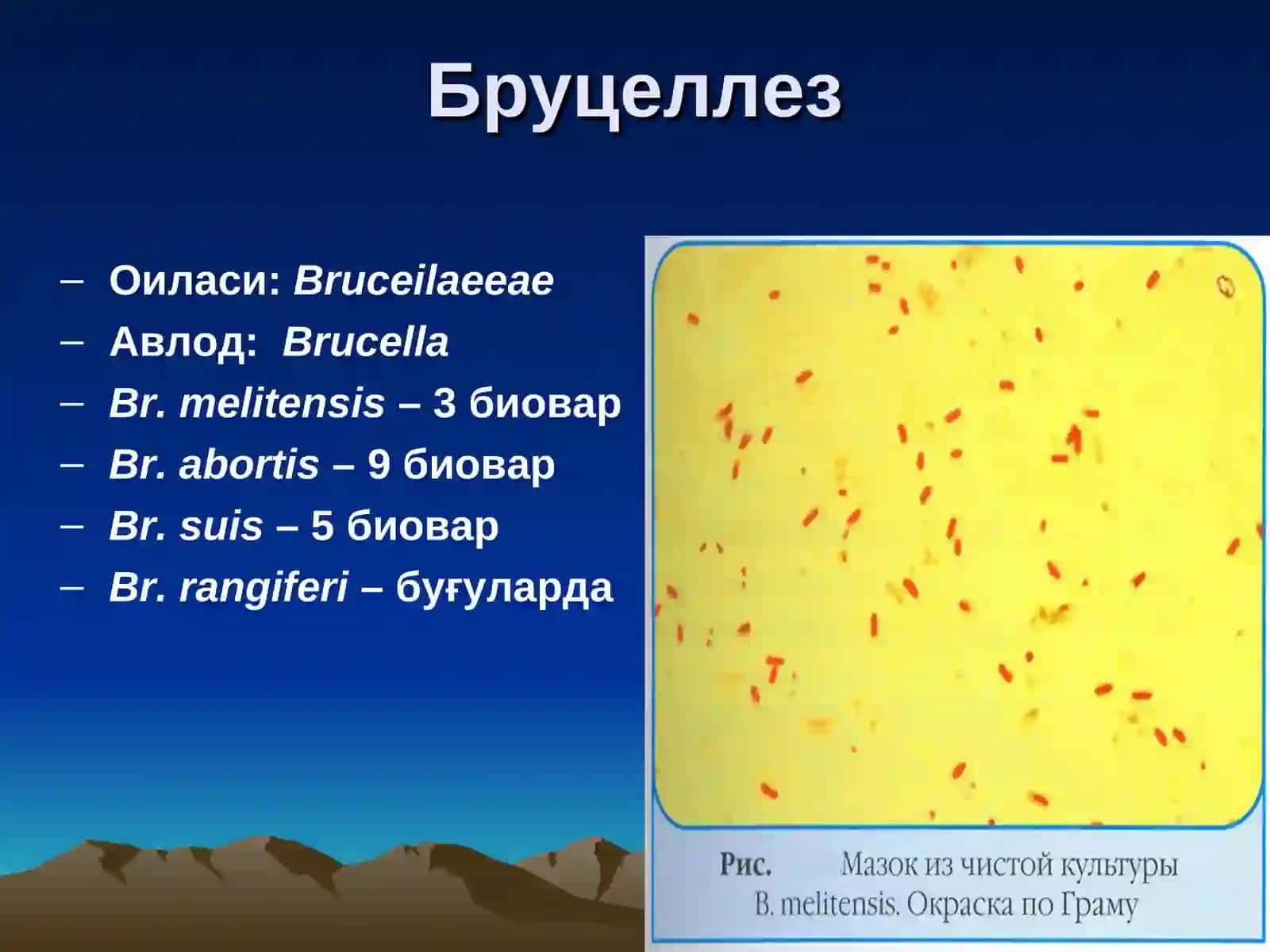 Бруцеллез, Куйдирги, Ўлат, Туляремия 4