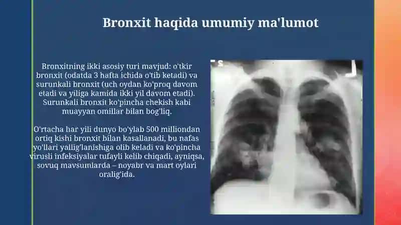 Bronxit pnevmoniya zotiljam 4