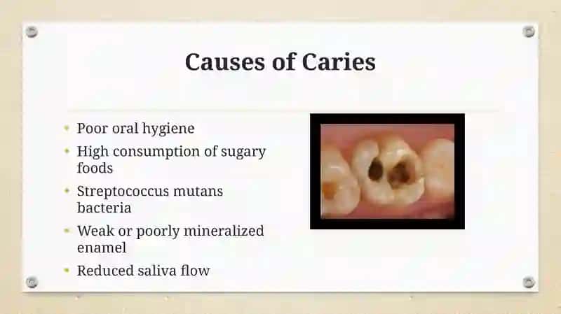 Thema.DENTAL CARIES 4