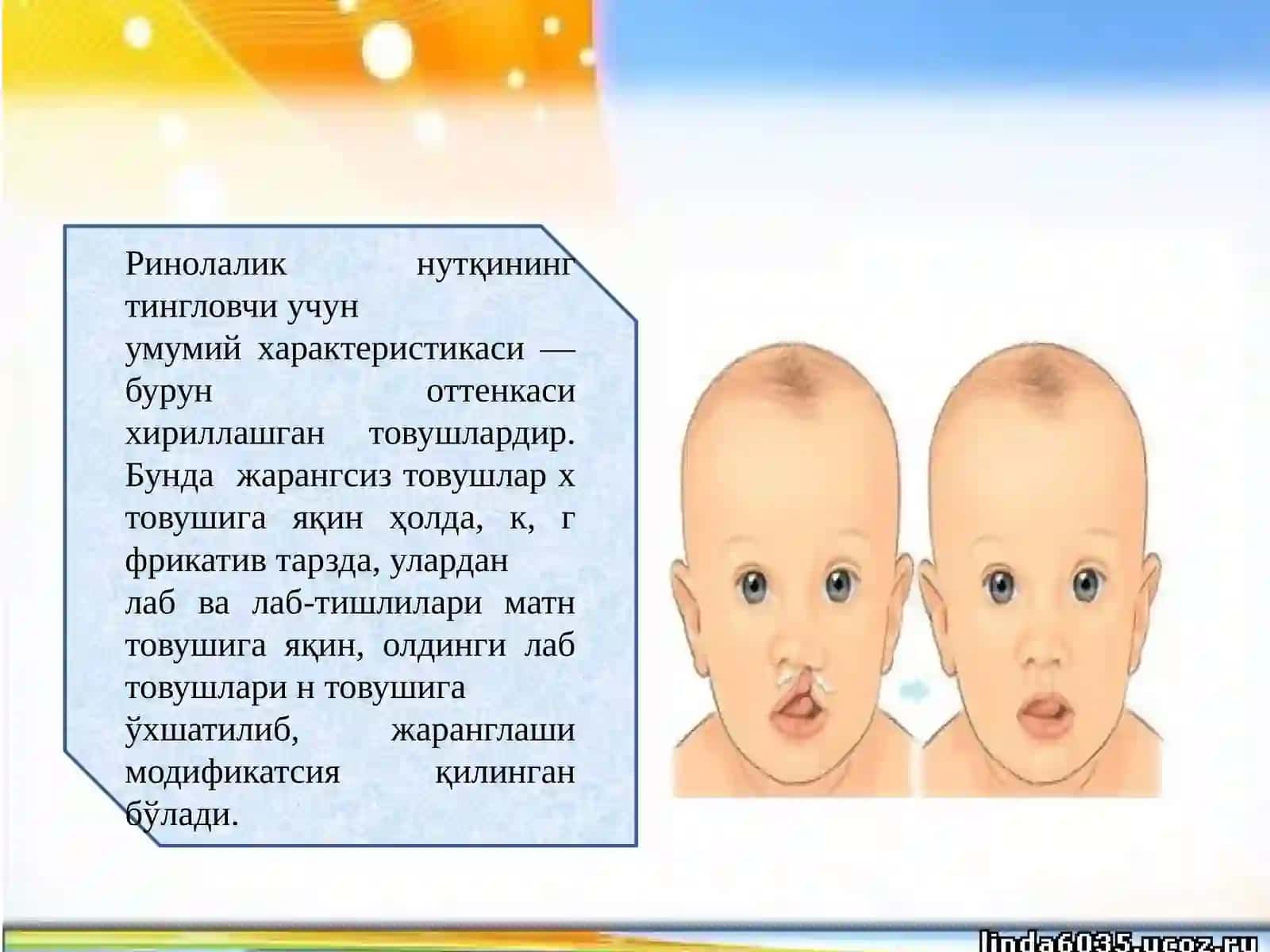 Ринолалиядан утқнинг ўзига хос ҳусусиятлари 4