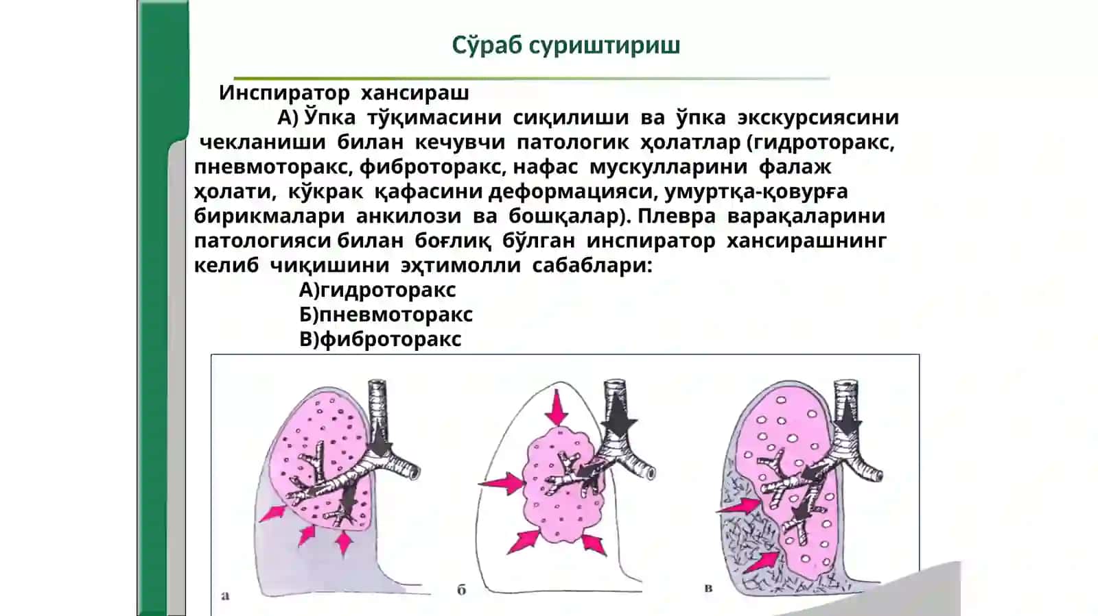 “Нафас тизими касалликларида  беморларни  текшириш. 4