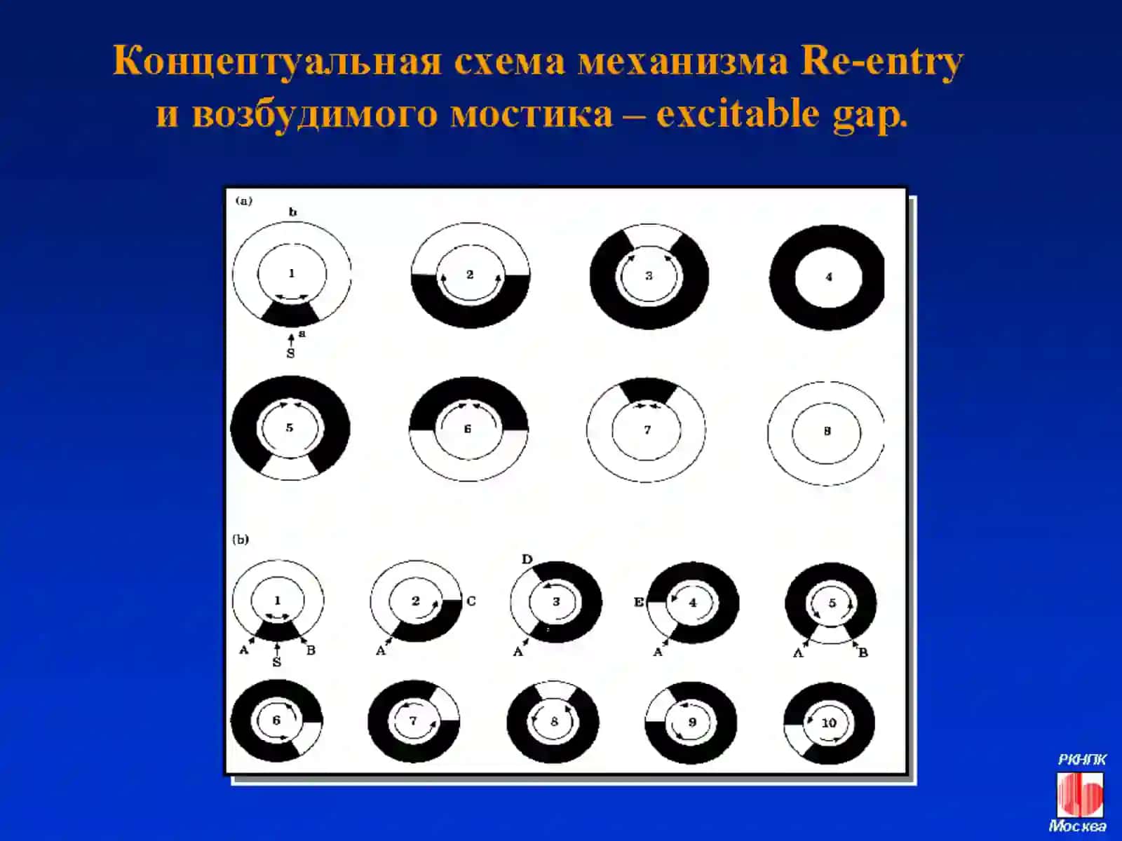 Электрокардиография –2 4