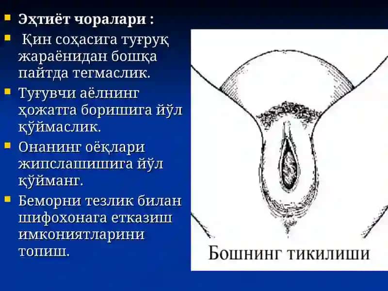 ЯНГИ ТУҒИЛГАН ЧАҚАЛОҚЛАРДА СТАЦИОНАР ШАРОИТИДАН ТАШҚАРИ ШОШИЛИНЧ ЁРДАМ КЎРСАТИШ 4
