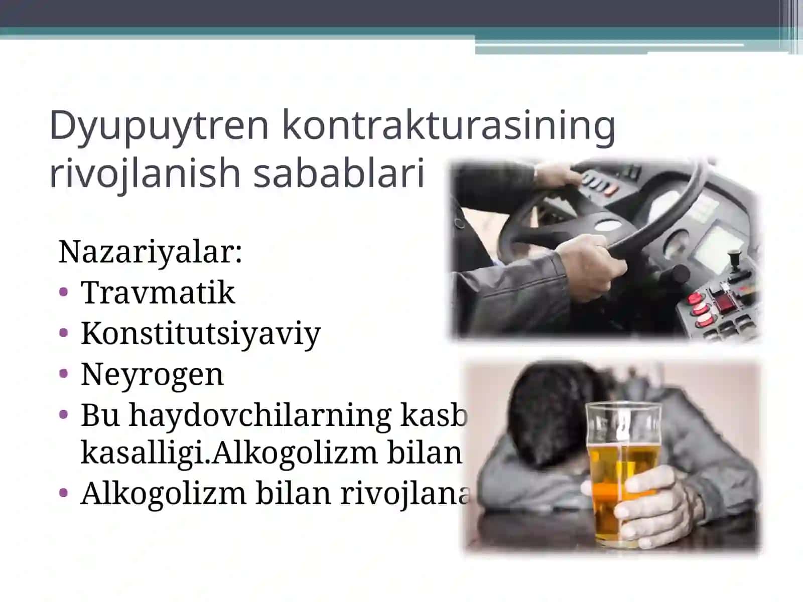 Dyupyuitren kontrakturasi 4