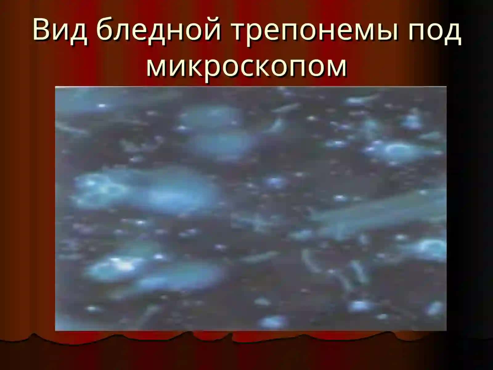 Сифилис 4