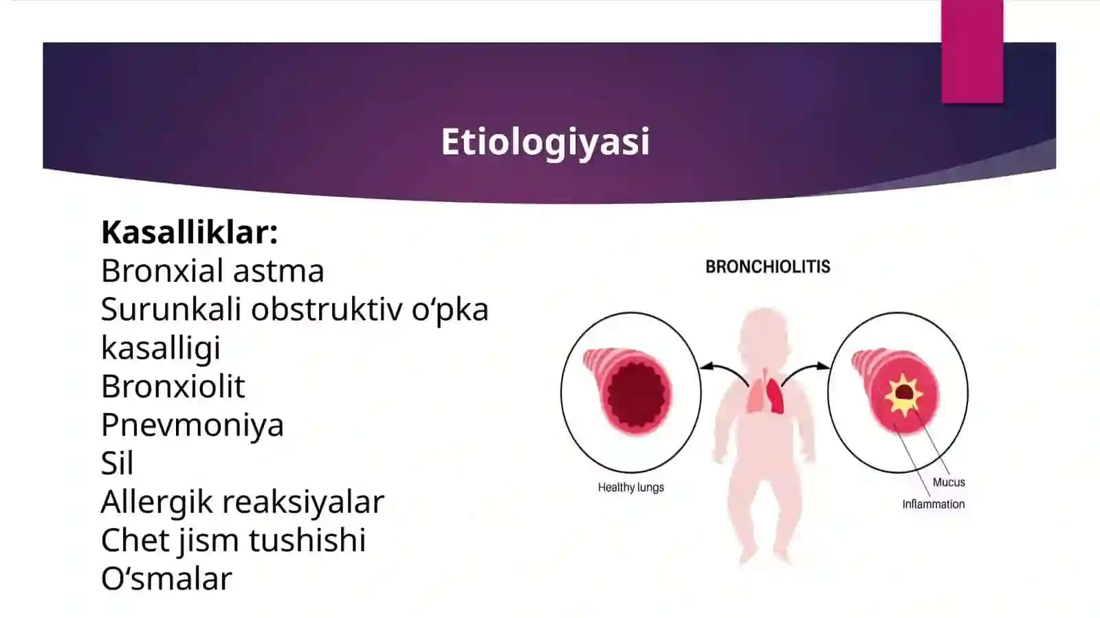 Bronxo-obstruktiv sindromda qiyosiy tashxislash 4