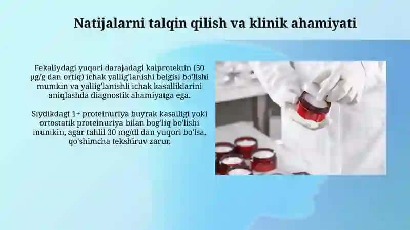 Siydik va najasni labarator tekshirish usullari 4