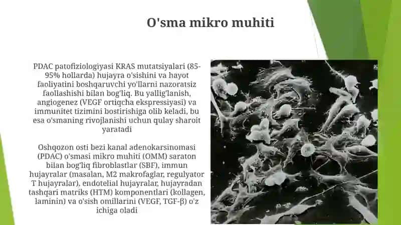 Oshqozonosti bezi raki patofiziologiyasi 4