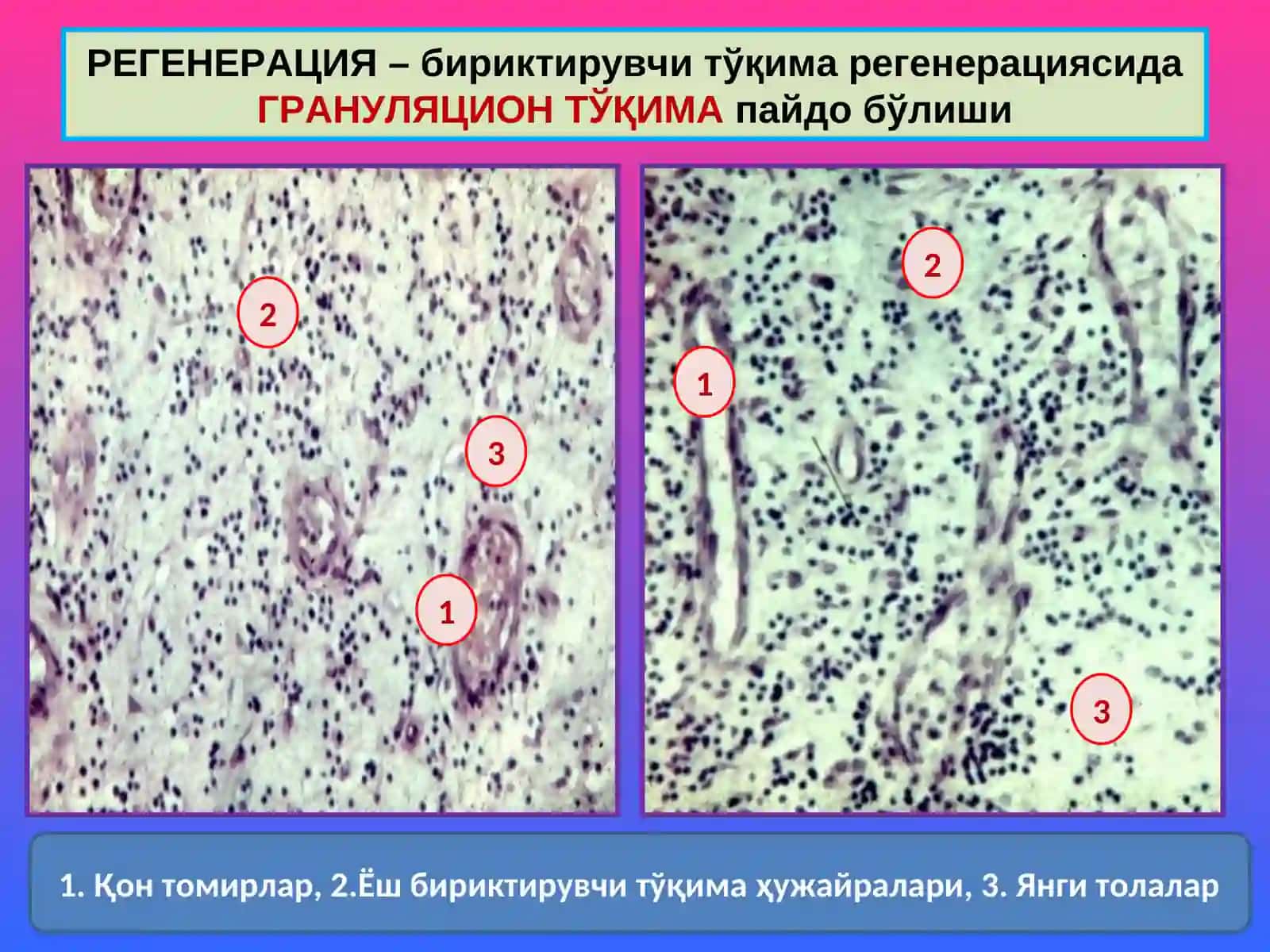 ПАТОЛОГИК АНАТОМИЯ 9- маъруза 4