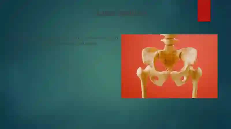 Osteomiyelit 4