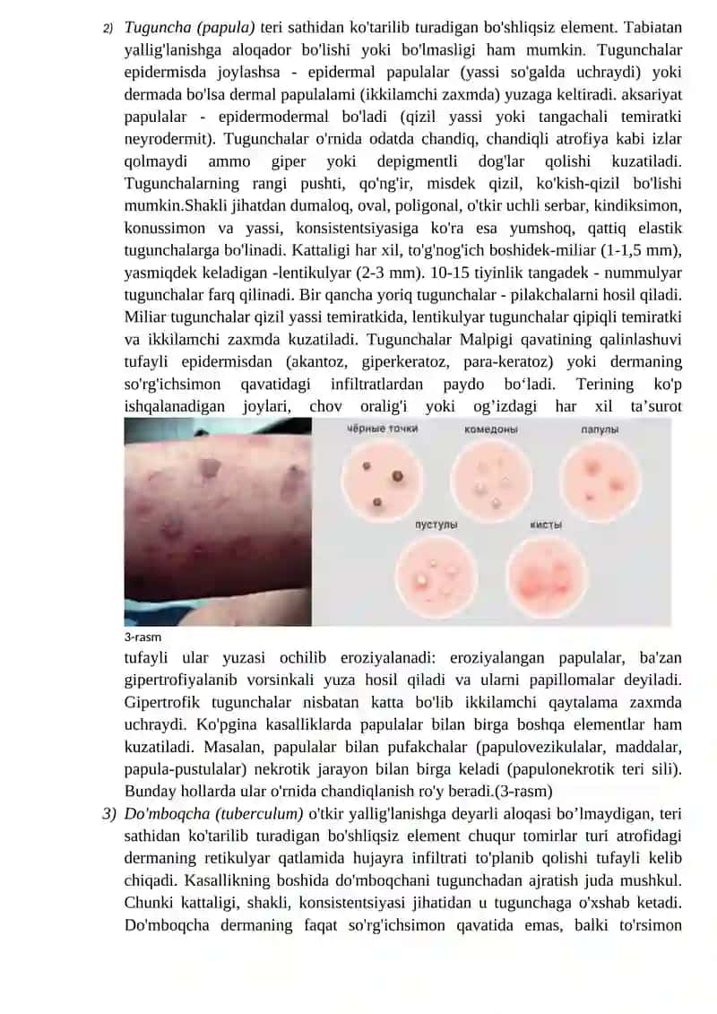 Teridagi patomorfologik o’zgarishlar 4