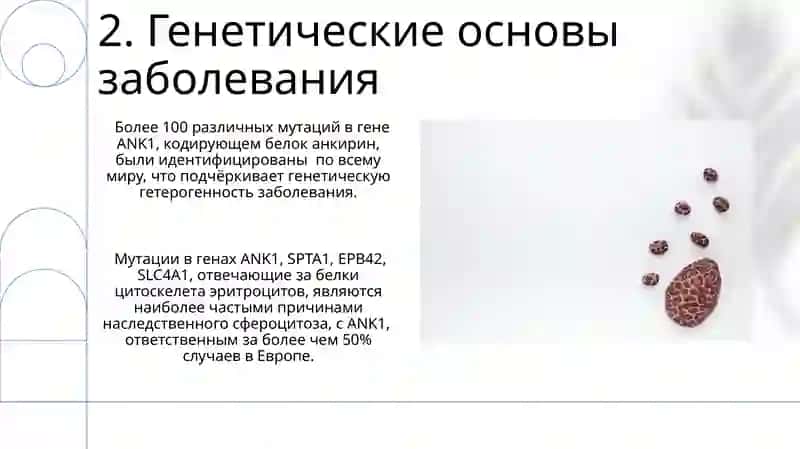 Наследственный микросфероцитоз 4
