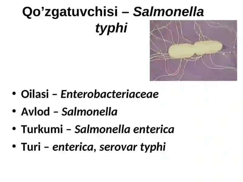 TIFOPARATIFOZ KASALLIKLAR 4
