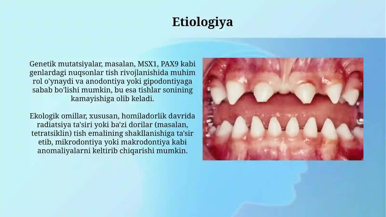 Tishlarning irsiy anomaliyalari 4