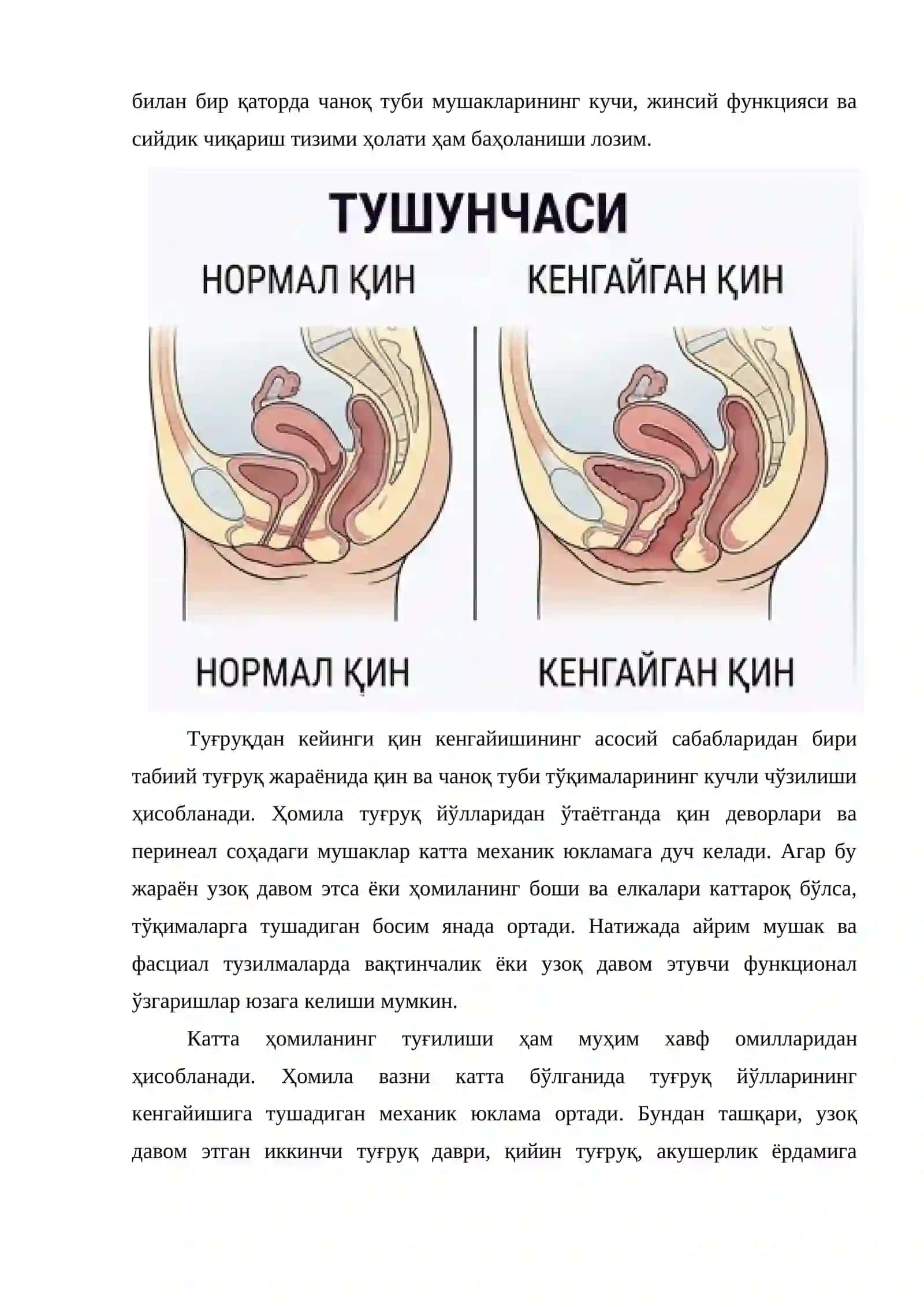 Туғруқдан кейинги қиннинг кенгайишини лазер аппарати ёрдамида торайтириш усуллари, асоратлари ва қарши кўрсатмалари 4