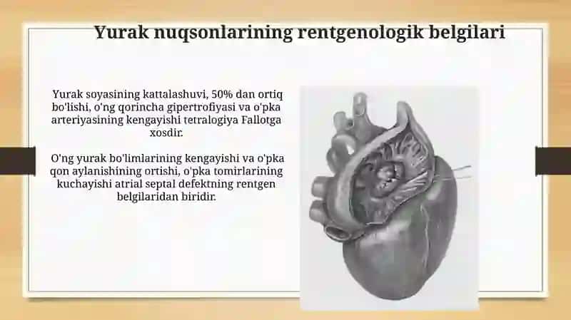 Yurak va Qon Tomirlarining Rentgen Anatomiyasi 4