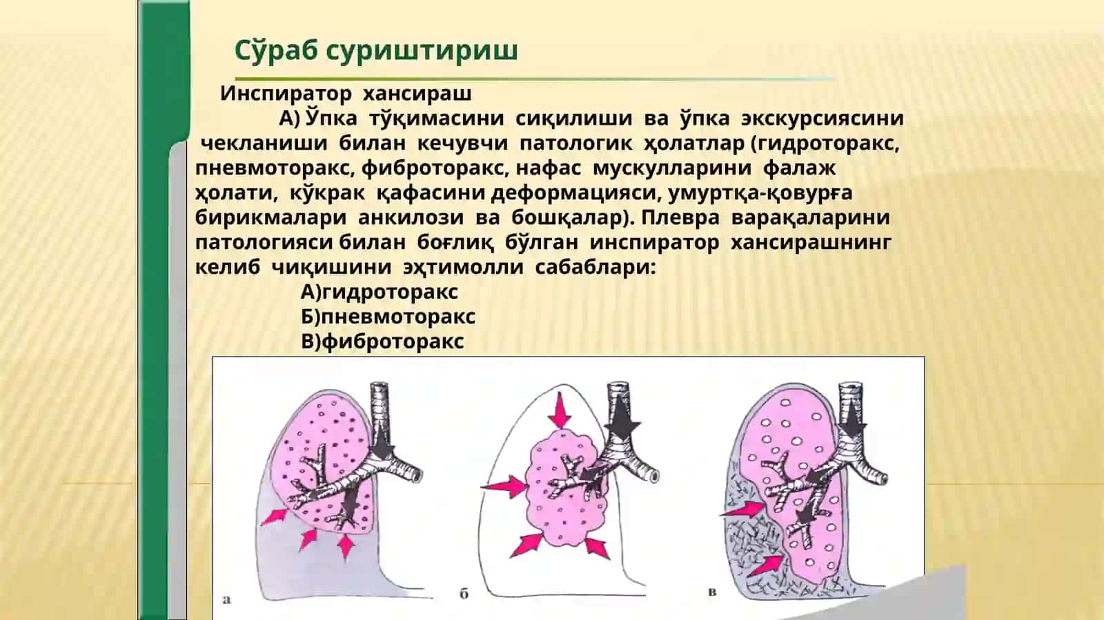 Нафас тизими касалликларида беморларни текшириш.Сураб суриштириш,упка палпация перкуссия аускультацияси 4