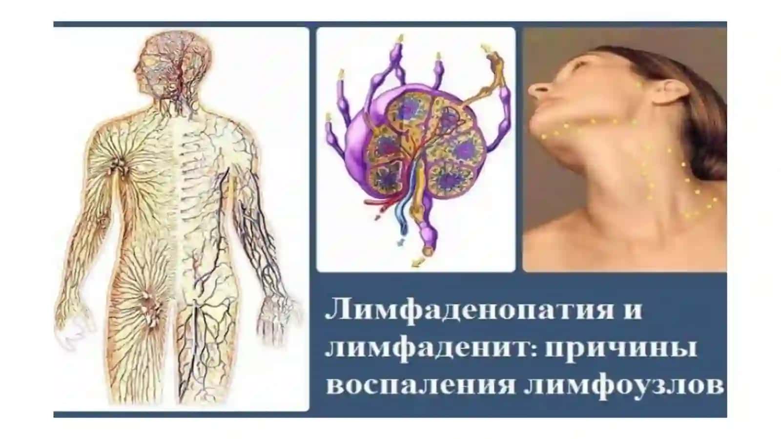 Yuza va chuqur limfa  tugunlarining jovlashuvi. KT va MRTda limfa tugunlari Morfologiyasi 4