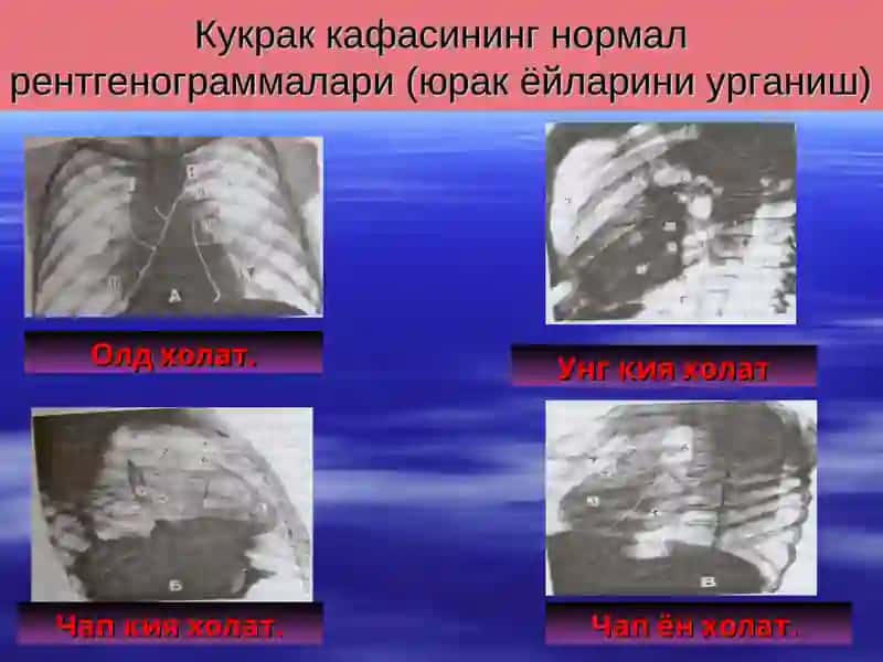 Юрак – қорин бўшлиғи ва кичик тос аъзолари травмаси нур ташхиси 4
