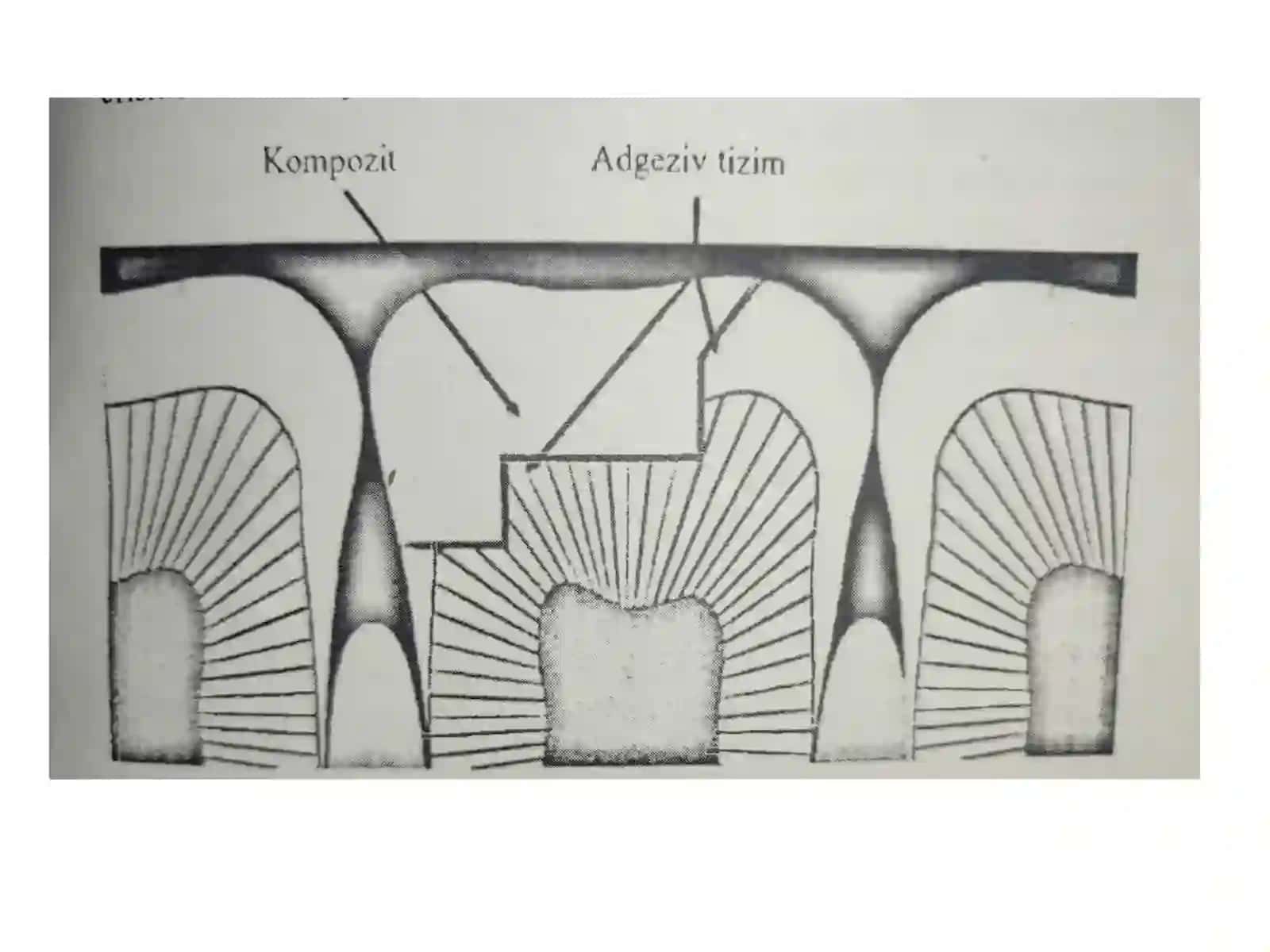 Adgeziv tizim 4