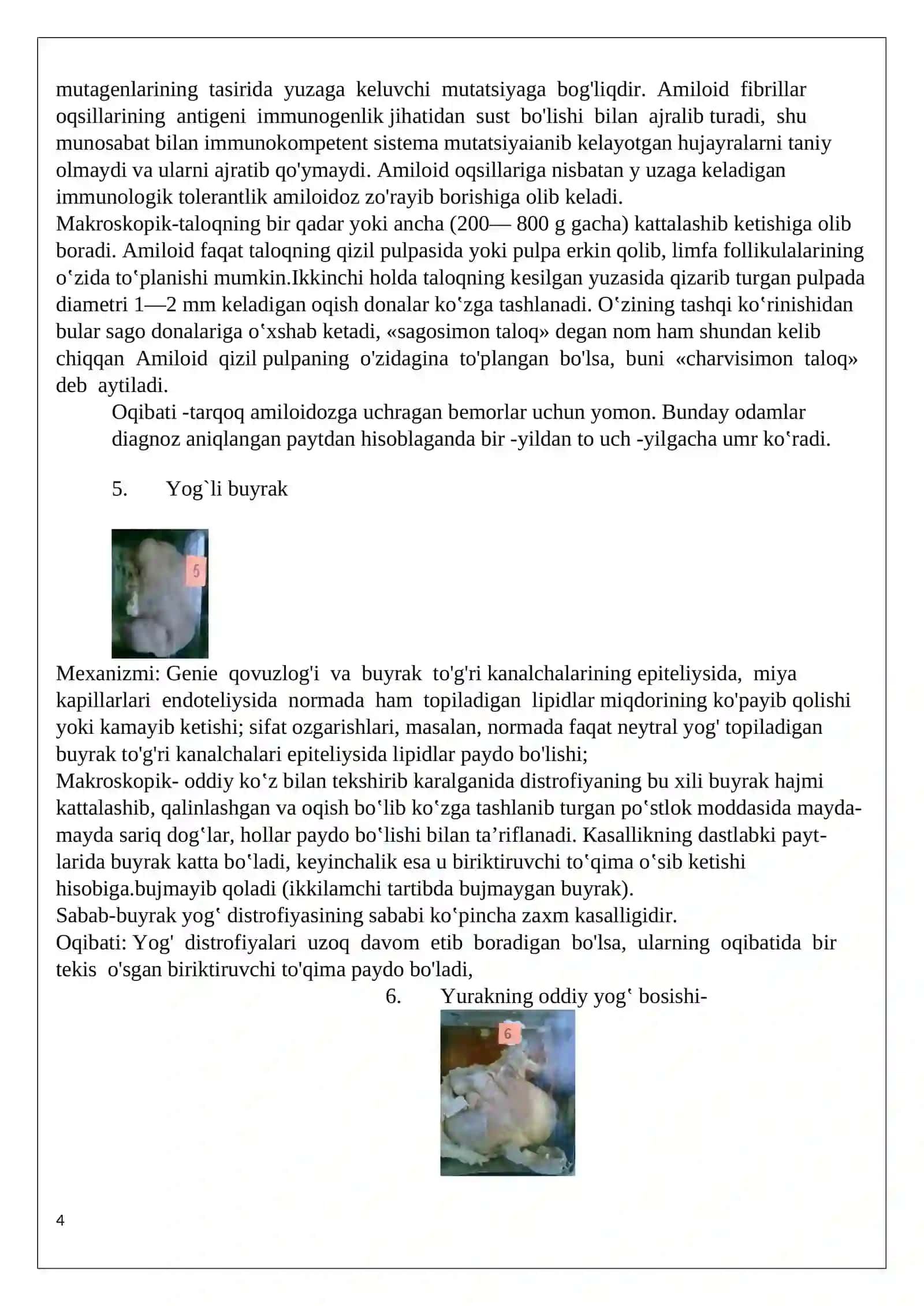 Til leykoplakiyasi -,,Oq til’’ Shilliq qavatlarning patologik muguzlanishi 4