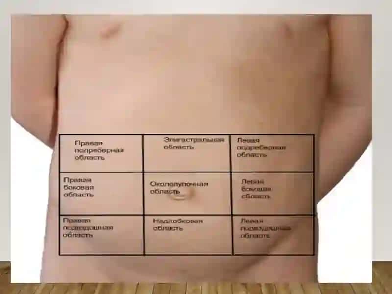 Острый живот 4